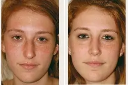 Make Over Cosmetic Surgery in Dubai