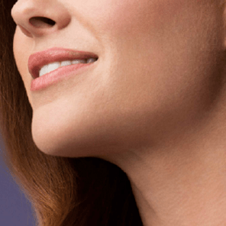 Masseter Botox Injection Dubai –  Jawline Botox