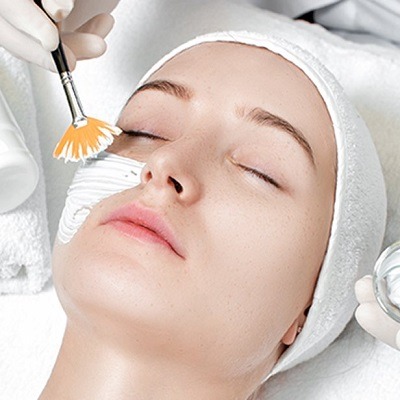 PCA Peel Treatment in Dubai & Abu Dhabi PCA Peel with Hydroquinone