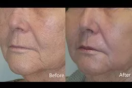 Skin Toning Treatment Clinic Dubai & Abu Dhabi