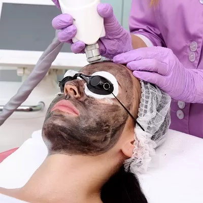 Spectra Laser Carbon Peel in Dubai, Abu Dhabi & Sharjah Spectra Peel