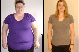 gastric bypass Clinic in Abu Dhabi