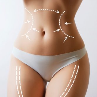 360 Liposuction in Dubai