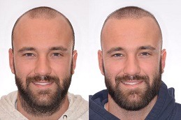 Best Hair Specialist in Abu Dhabi