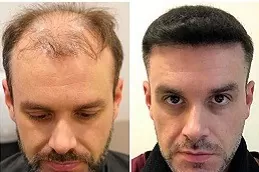 Best Hair Specialist in Dubai, Abu Dhabi & Sharjah