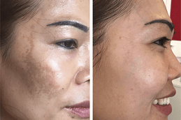 Concentrated Growth Factor Clinic in Abu Dhabi