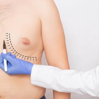 Gynecomastia Surgery Cost in Dubai UAE