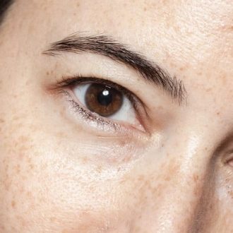 Botox Brow Lift for Hooded Eyes in Dubai