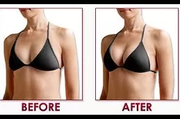 Breast Reconstruction Clinic in Abu Dhabi