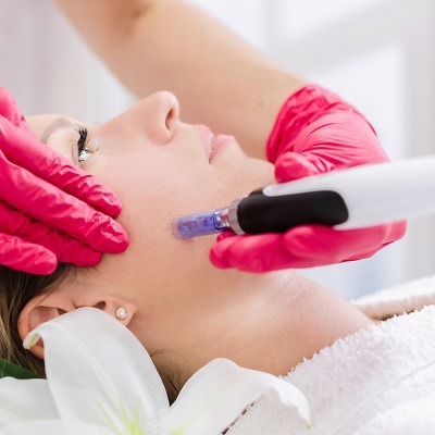 Microneedling With PRP Treatment Cost in Dubai