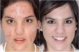 Skin Diseases Clinic in Abu Dhabi