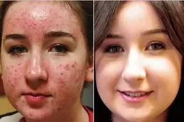 Skin Diseases Clinic in Dubai