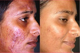 Skin Diseases Dubai & Abu Dhabi