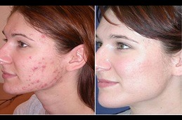Skin Diseases in Abu Dhabi