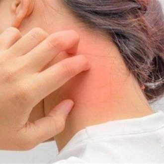 Best Dermatologist in Dubai for Vitiligo