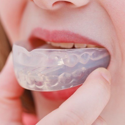 Best Mouthguard for Grinding Teeth in Dubai UAE