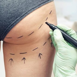 Brazilian Plastic Surgeon in Dubai & Abu Dhabi