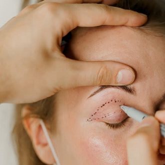 Eyelid Surgery for Droopy Eyelids Dubai