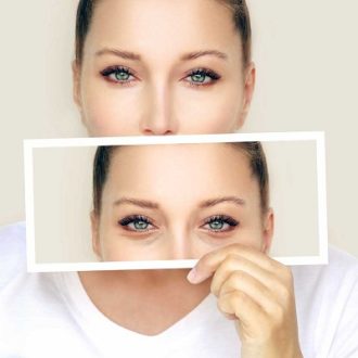 Eyelid Surgery for Hooded Eyes Cost in Dubai