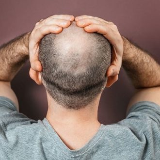 Hair Loss Treatment Cost in Dubai & Abu Dhabi