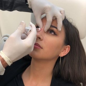 Non Surgical Rhinoplasty Cost Dubai & Abu Dhabi