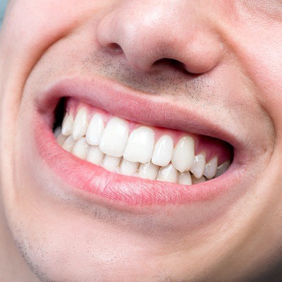 Teeth Grinding Treatment in Dubai & Abu Dhabi Grinding & Bruxism Cost