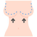 Illustration of breast lift surgery showing arrows indicating lifting procedure and dotted lines marking incision areas.