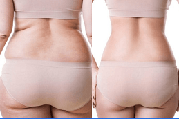 Best Clinic of Non-Surgical Weight Loss Dubai & Abu Dhabi