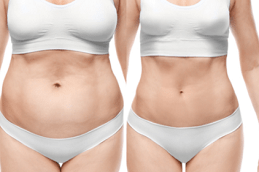 Best Clinic of Non-Surgical Weight Loss in Dubai & Abu Dhabi