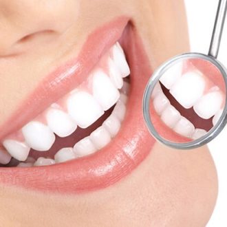 Composite Filling Cost in Dubai & Abu Dhabi