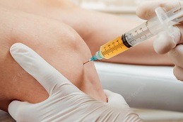 Best PRP Injection for Ligament Tear in Dubai