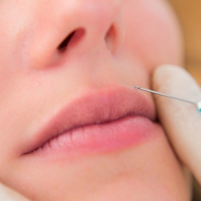 Botox Lip Flip Cost in Dubai, Abu Dhabi & Sharjah Botox Price