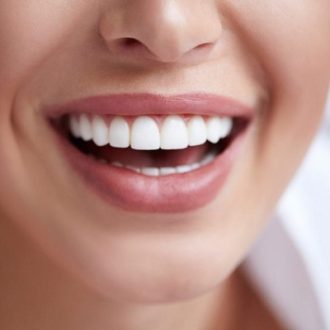 E max Veneers Cost in Dubai