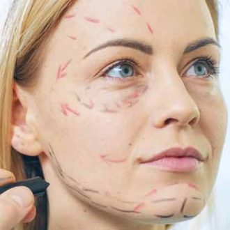 Facelift Surgery Cost in Dubai & Abu Dhabi UAE