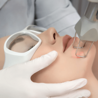 Fractional CO2 Laser Treatment Cost in Dubai