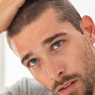 Hair Transplant Laser in Dubai & Abu Dhabi