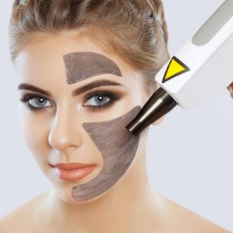 Laser Carbon Peels: How Does it Work?