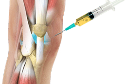 PRP Injection for Ligament Tear in Dubai
