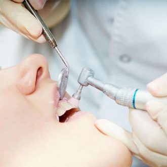 Scaling and Polishing Price in Dubai & Abu Dhabi