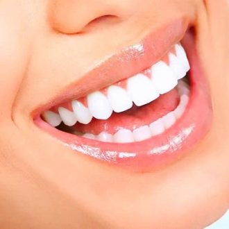 Teeth Whitening Cost in Dubai