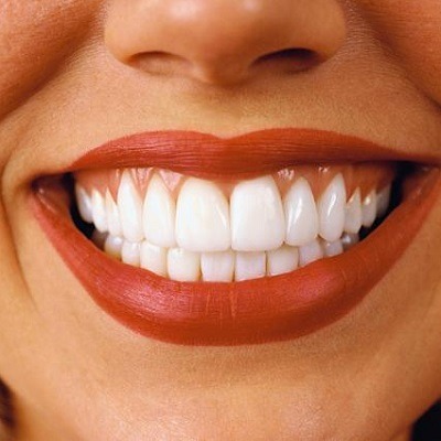 Teeth Whitening Strips Cost in Dubai & Abu Dhabi