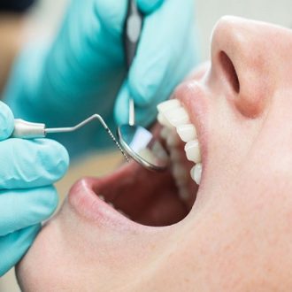 Root Canal Treatment for Broken Teeth in Dubai
