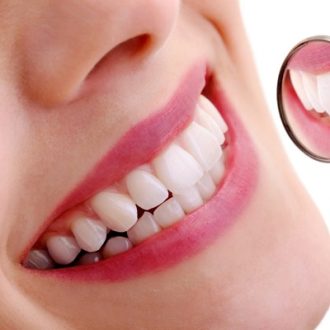 Smile Makeover with Crowns in Dubai & Abu Dhabi