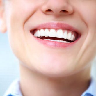 Smile Makeover with Direct Composite Veneers