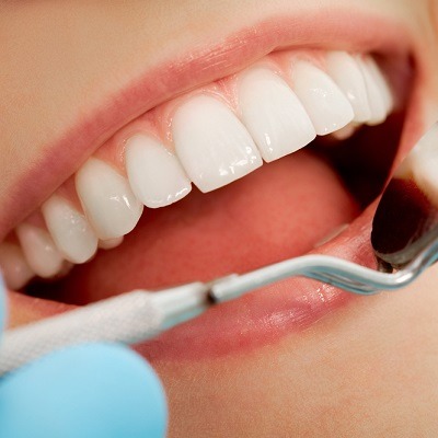 Teeth Whitening for Over 60s Near Dubai & Abu Dhabi Price & Cost