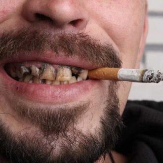 Teeth Whitening for Smokers in Dubai & Abu Dhabi