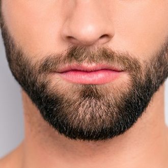 Beard Facial Hair Transplant Dubai