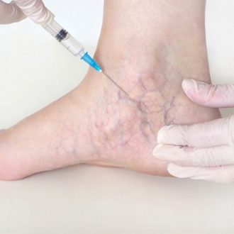 Best Vascular Surgeon in Dubai & Abu Dhabi