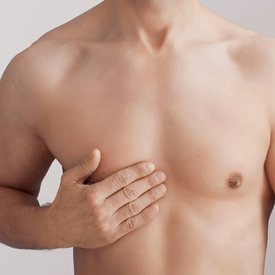 Can You Get Gynecomastia Treatment Without Surgery in Dubai Cost