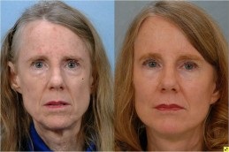 Cosmetic Injectables Clinic in Dubai & Sharjah